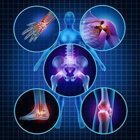 Cómo facilitar la movilidad de las articulaciones con artritis y osteoartritis durante el tratamiento