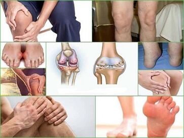 Cómo prevenir el desarrollo de artritis y artrosis